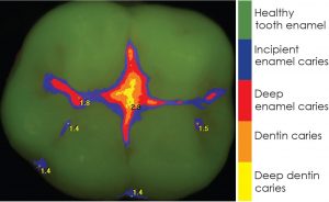 Grand Rapids Dental Spectra Image