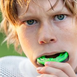 Sports Mouth Guard Dentist Holland MI